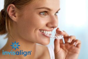 Invisalign marketing material