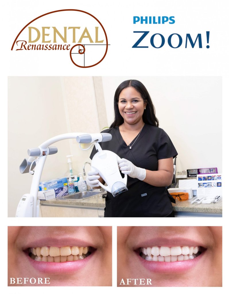 Zoom Whitening marketing material